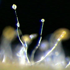 Fruiting stalks of dictyostelium (click for source)